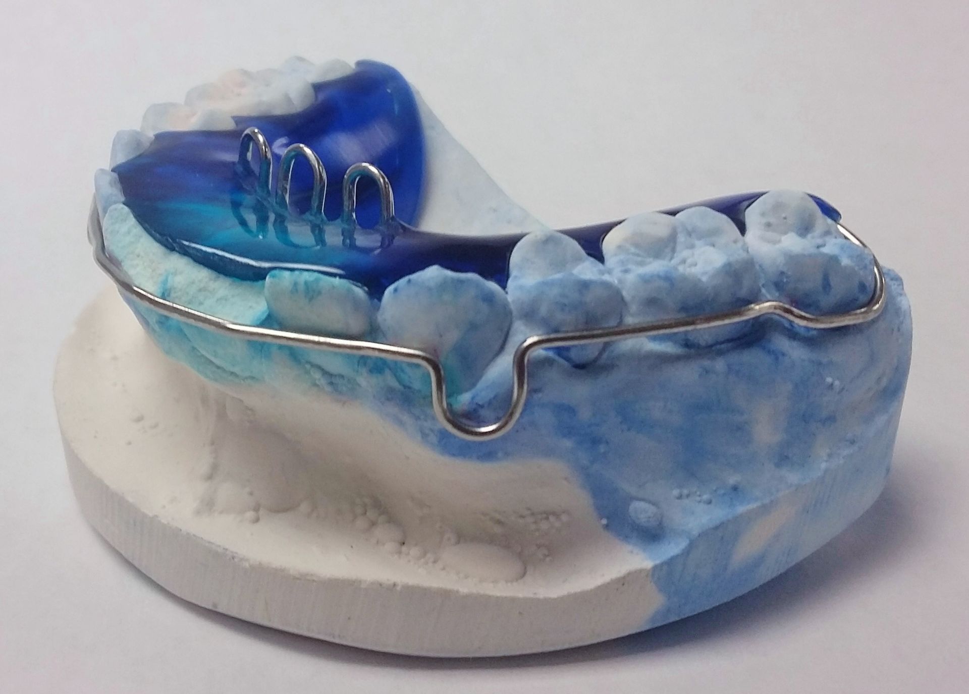 A model of a mouth with braces on it