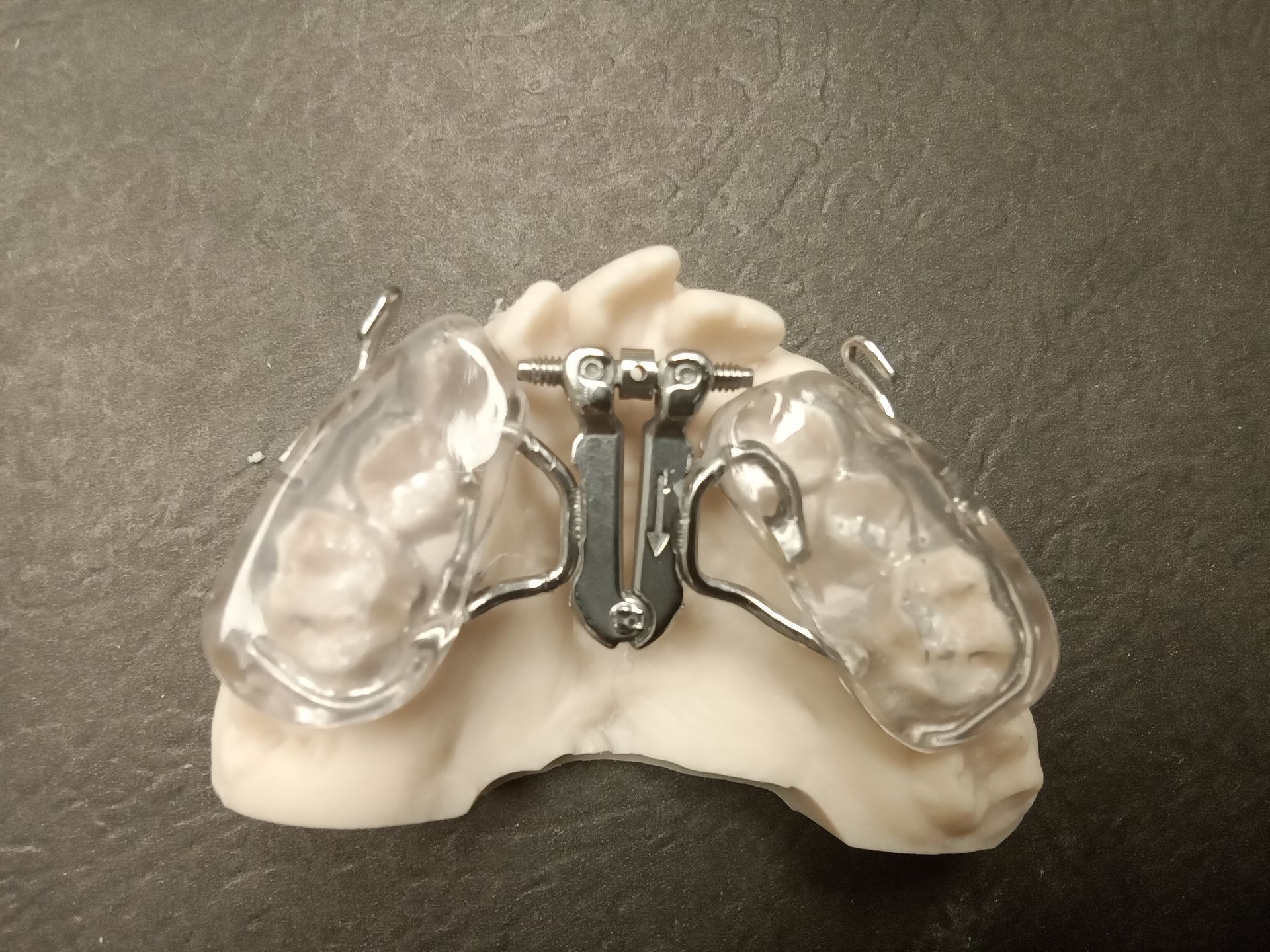 A close up of a dental appliance on a black surface
