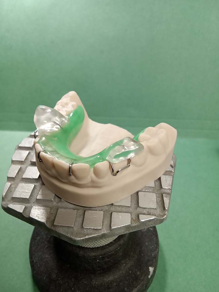 A model of a person's teeth with a green mouth guard