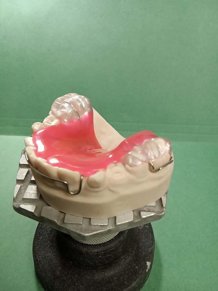 A model of a person's teeth is sitting on a table.