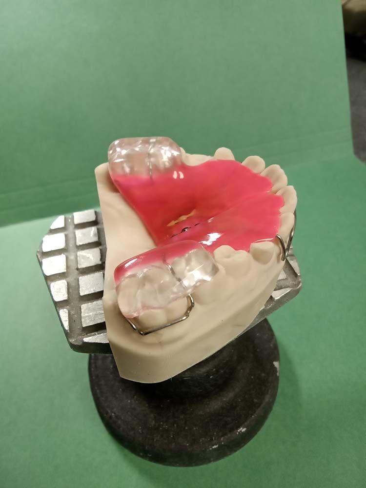 A model of a person's teeth is sitting on a green table