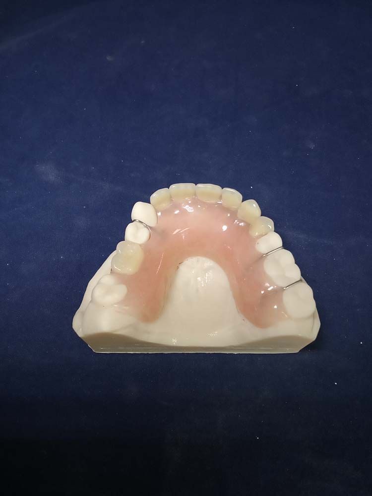 A model of a person's teeth on a blue surface