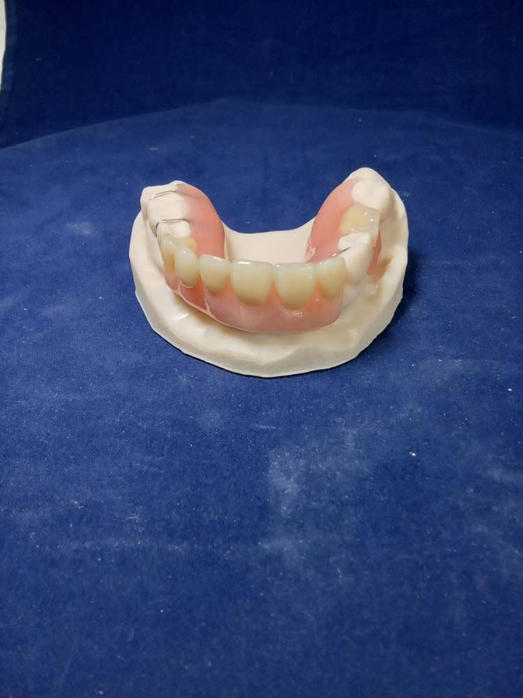 A model of a denture is sitting on a blue cloth