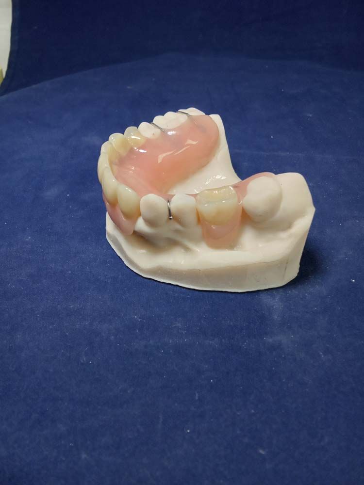 A model of a denture