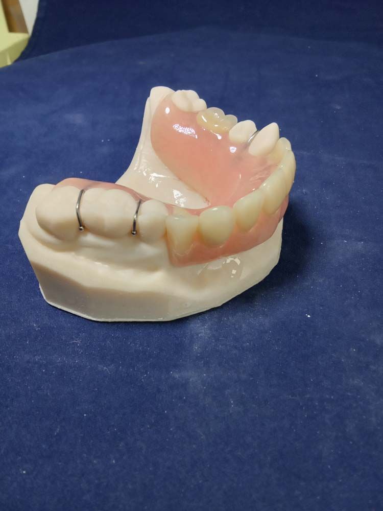 A model of a denture is sitting on a blue surface