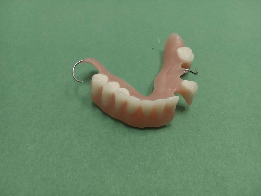 Partial denture, pink base with white teeth and metal clasps on a green surface.