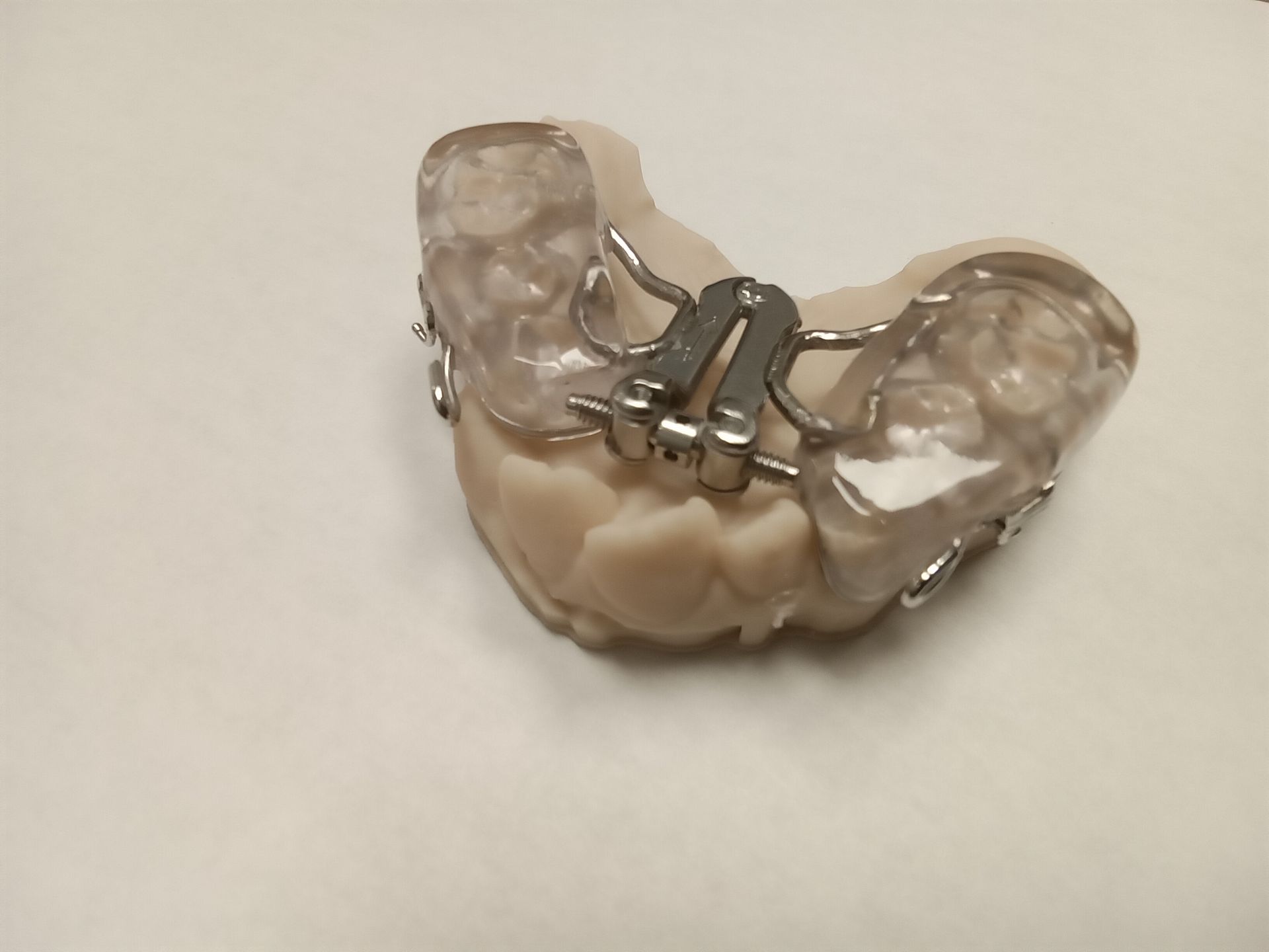 A model of a mouth with a dental device on it