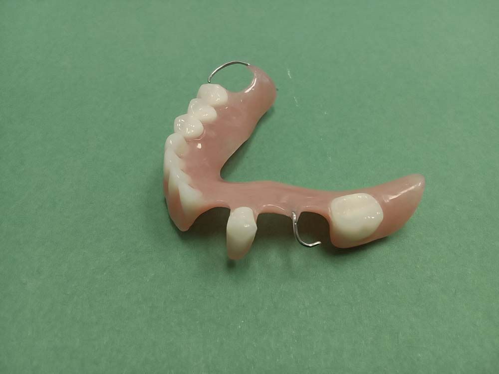 A denture is laying on a green surface.