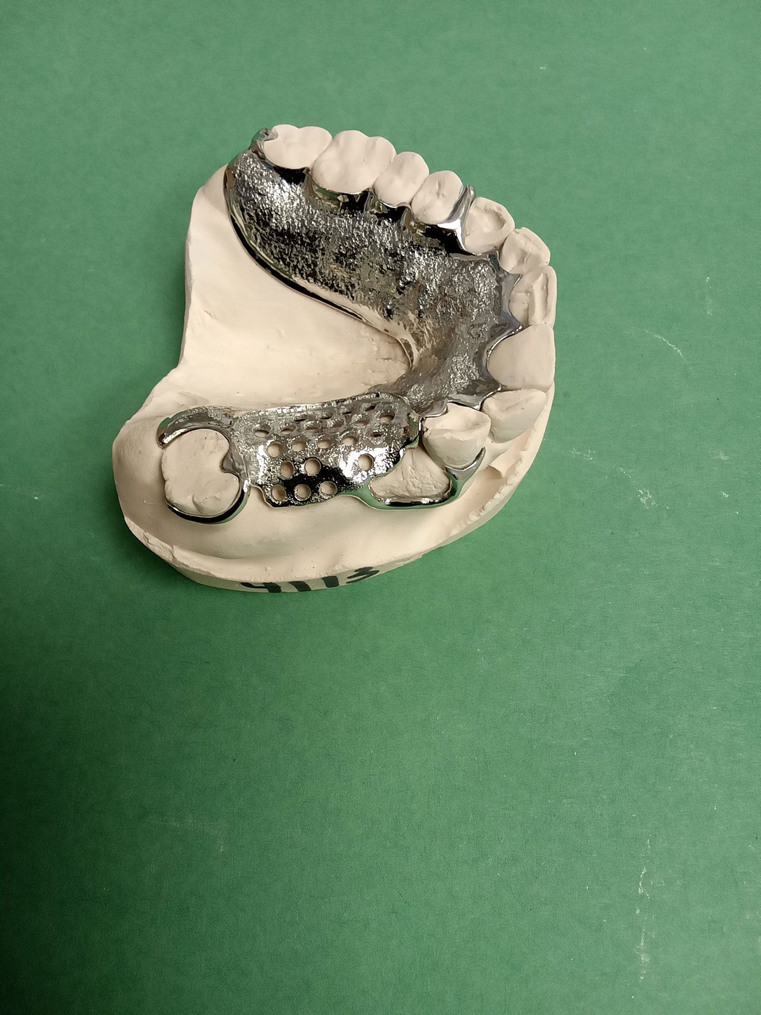 A close up of a dental model on a green surface.