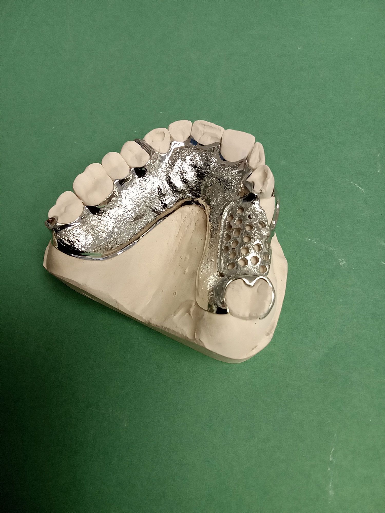A model of a person's teeth with a metal bracket on a green surface.