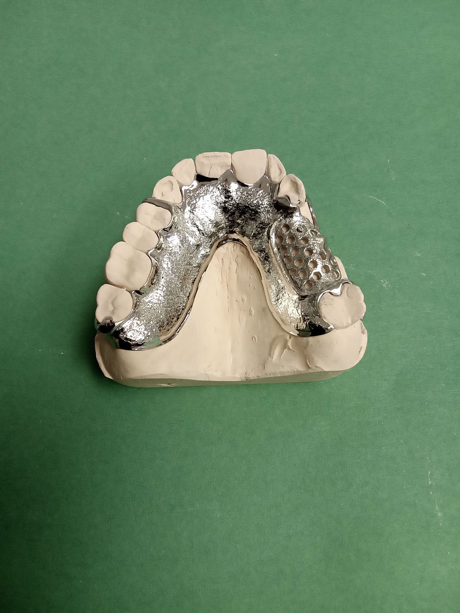 A model of a person's teeth on a green surface.