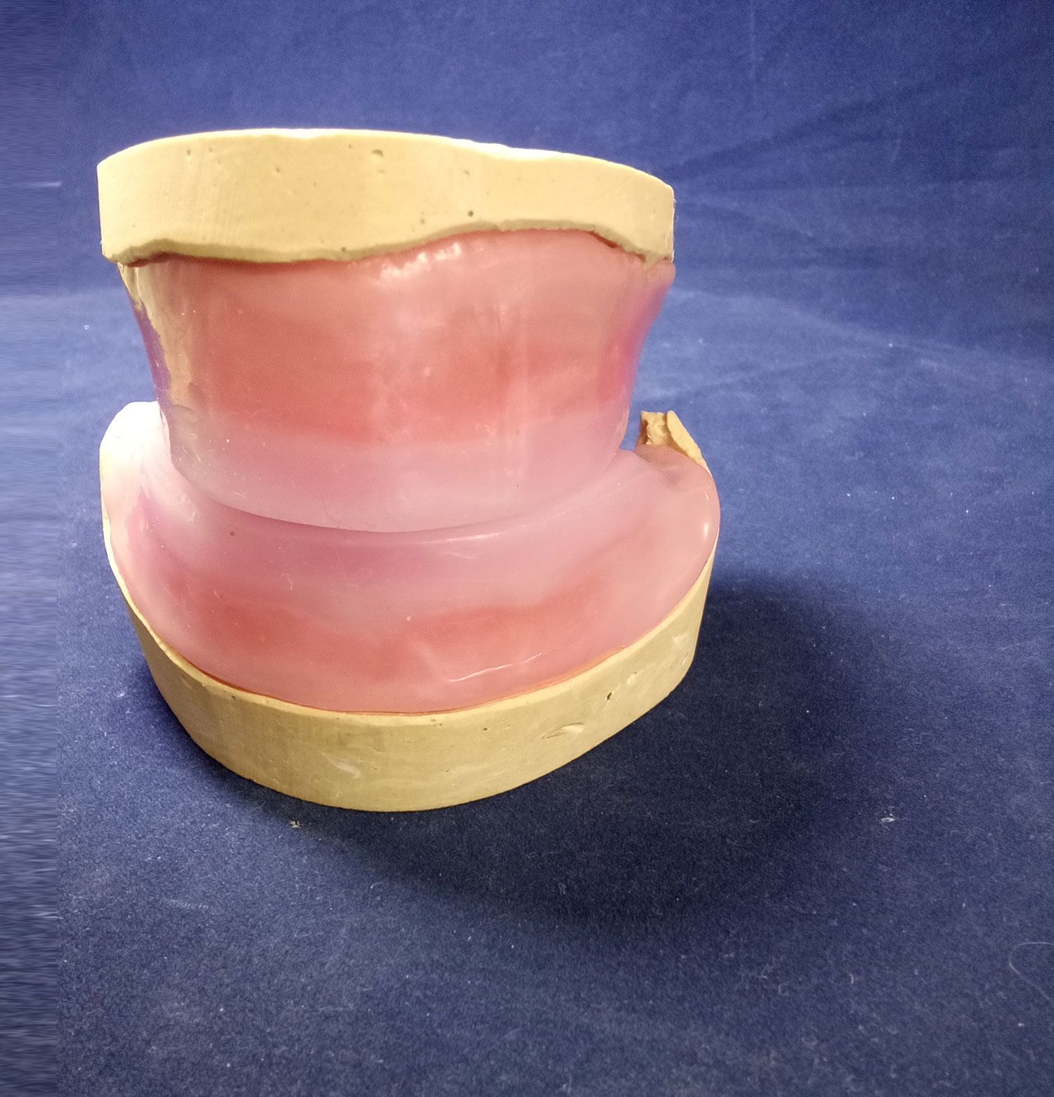 A model of a person's teeth is sitting on a blue surface