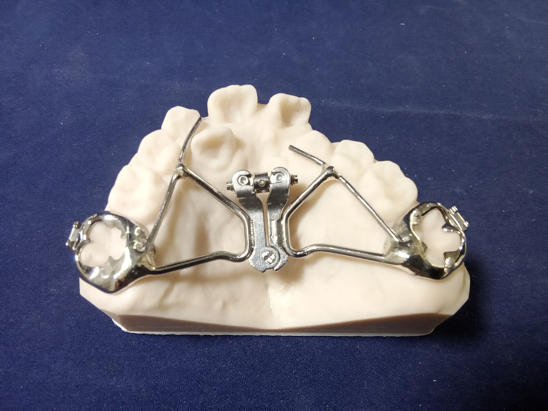 A close up of a dental appliance on a black surface