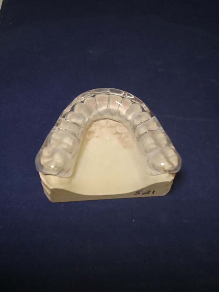 A dental model of a person's teeth is sitting on a blue surface.