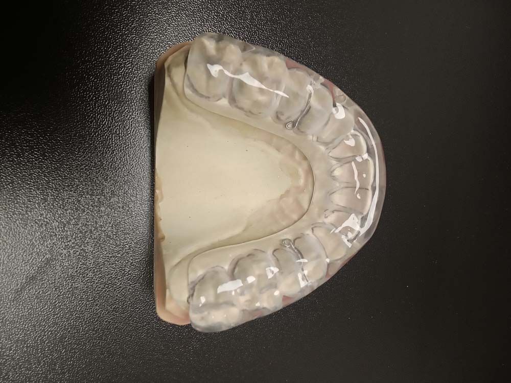 A dental model of a person's teeth is sitting on a black surface.