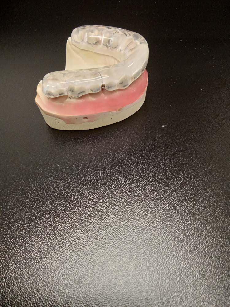 A dental model with a mouth guard on it is sitting on a black surface.
