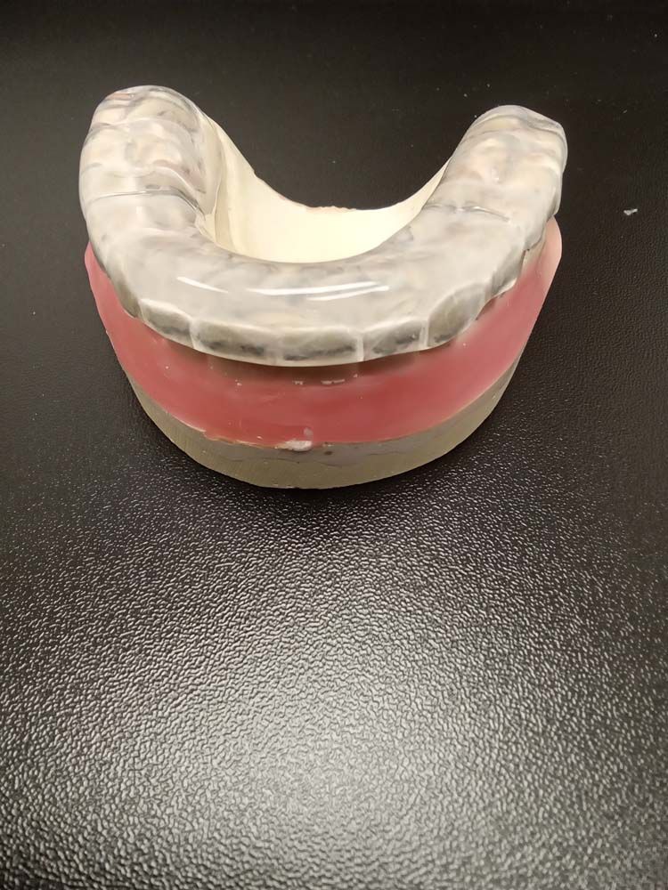 A tooth model is sitting on a black table.