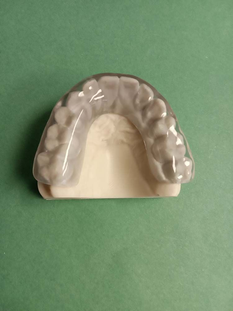 A dental model of a person's teeth is sitting on a green surface.