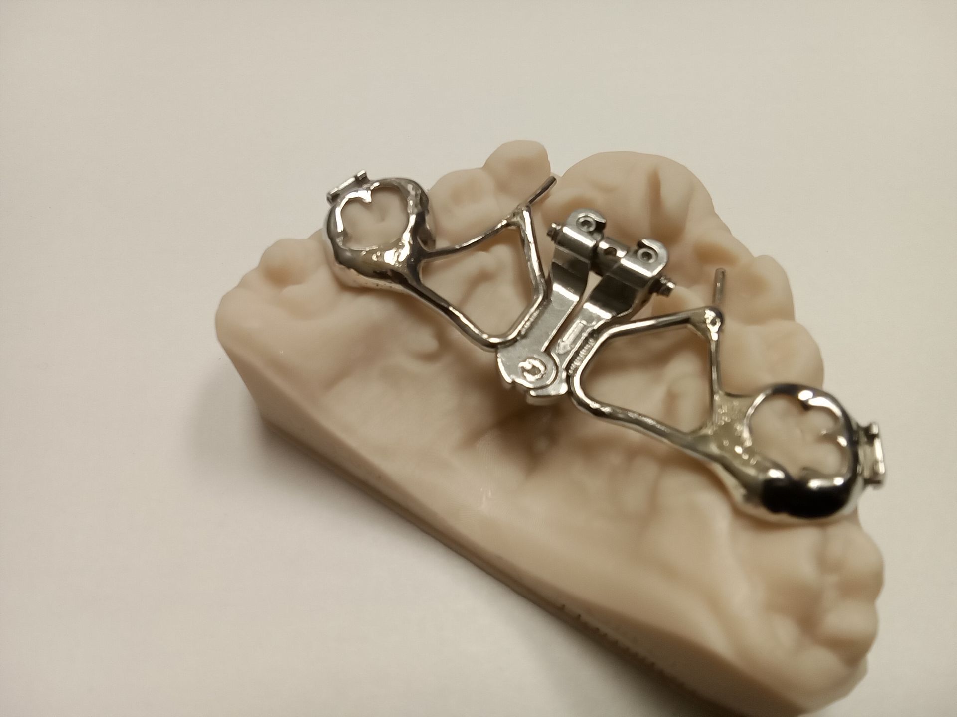 A model of a tooth with a metal brace on it