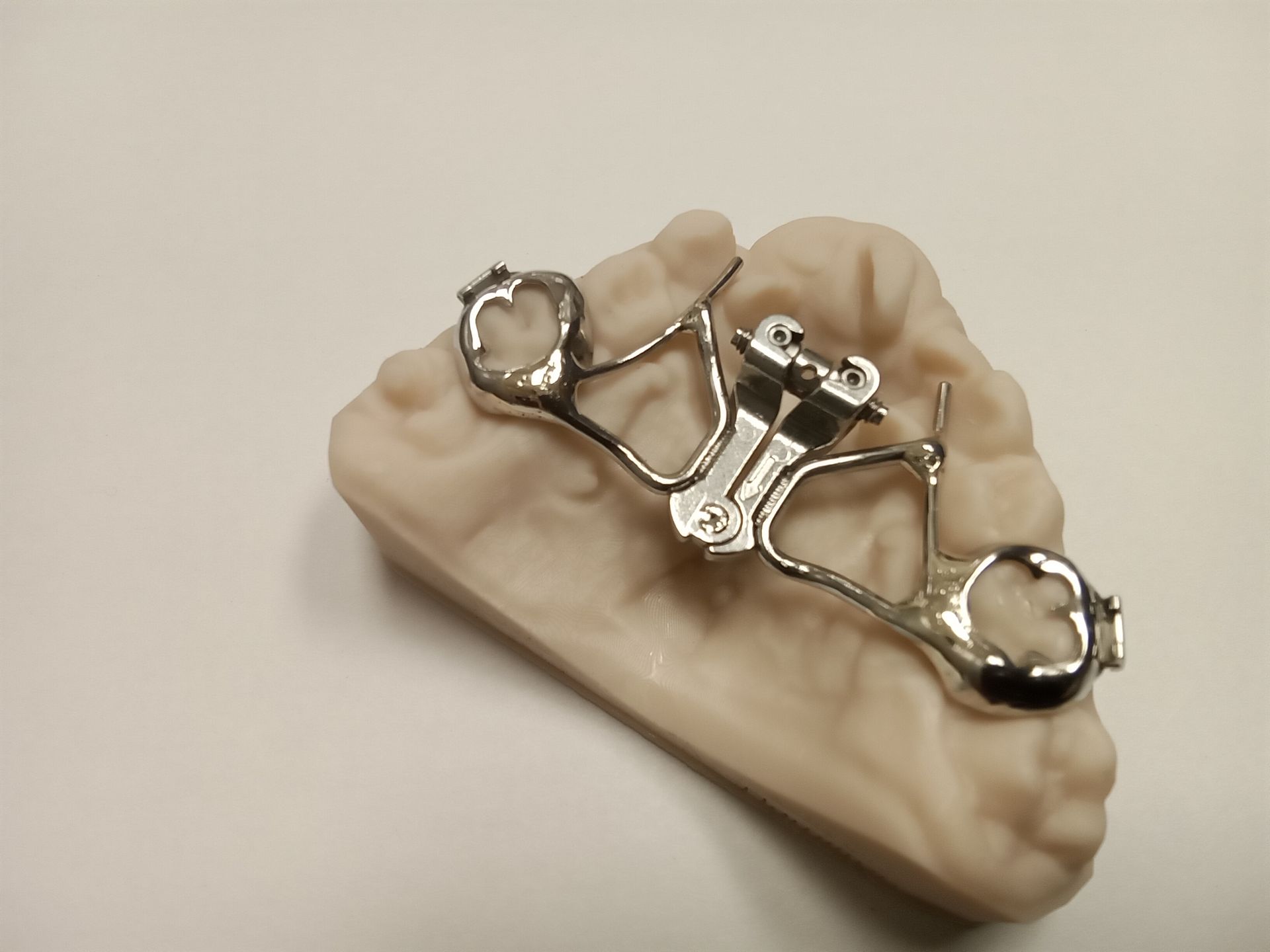 A model of a tooth with a metal brace