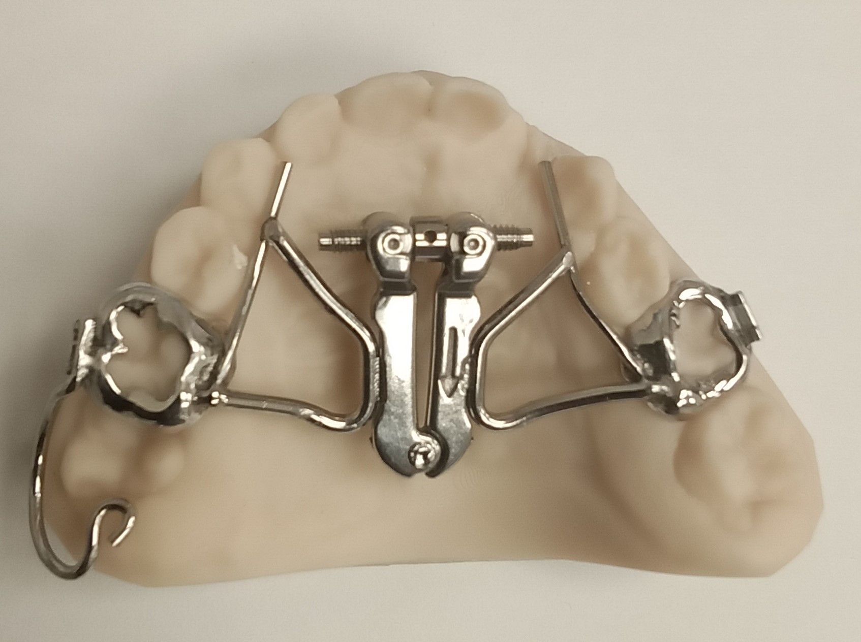A model of a tooth with a metal brace
