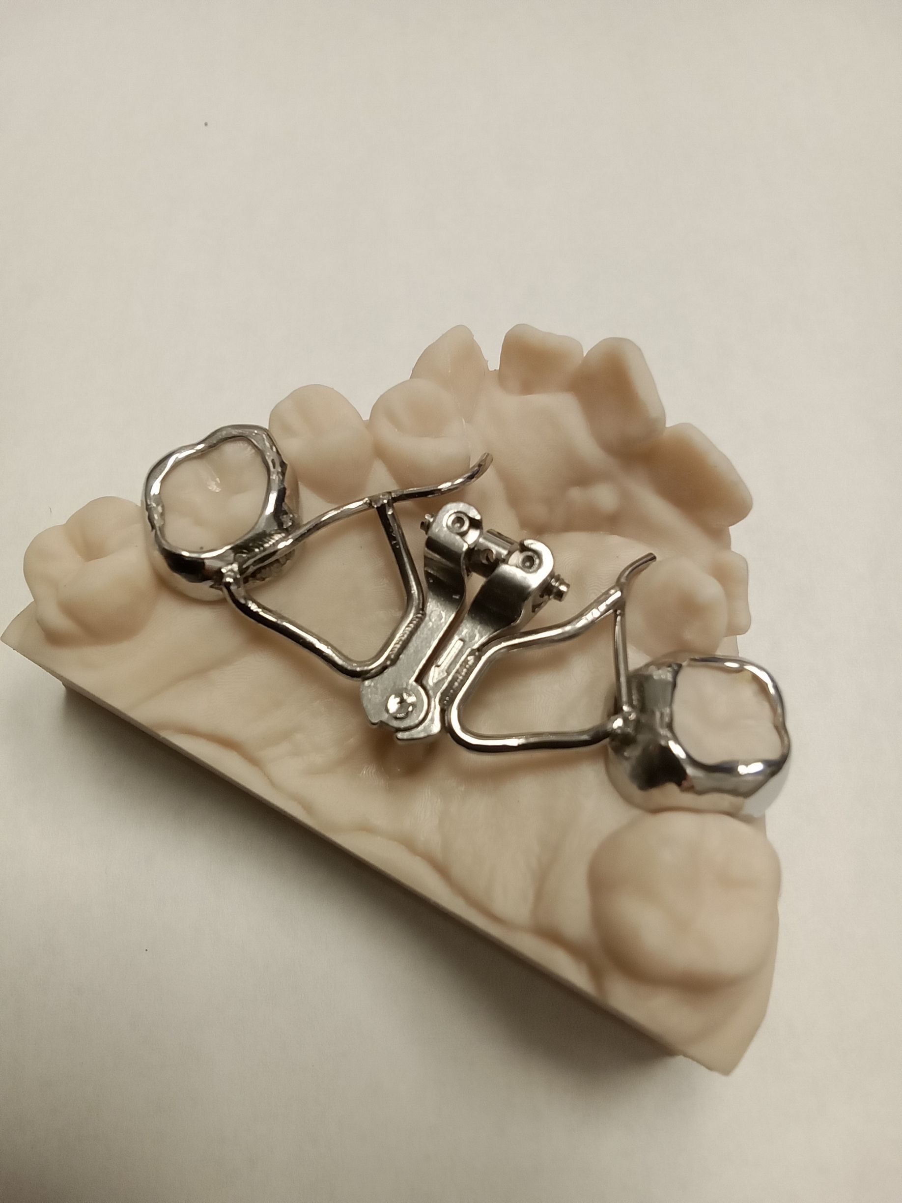 A model of a person's teeth with a metal brace on it