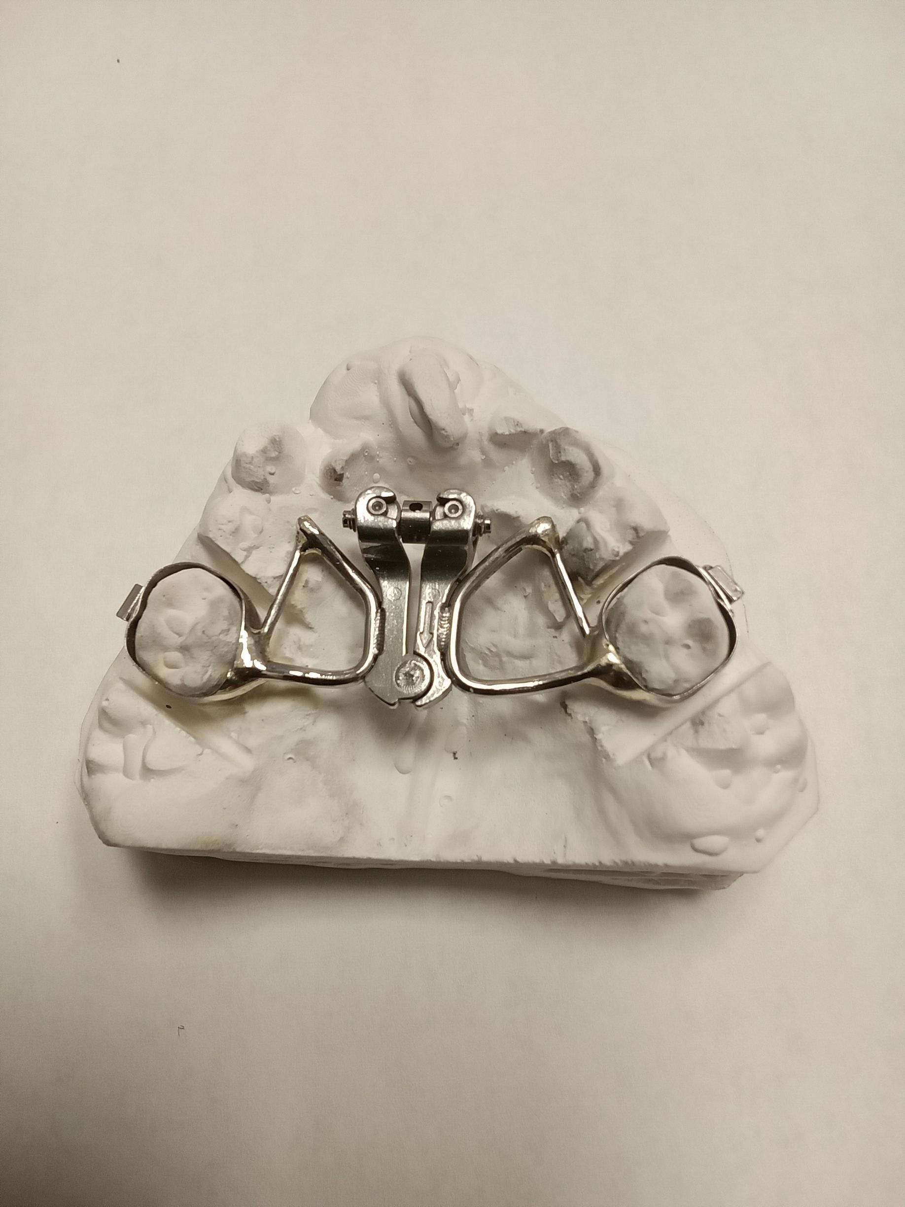 A pair of glasses is sitting on top of a dental model.