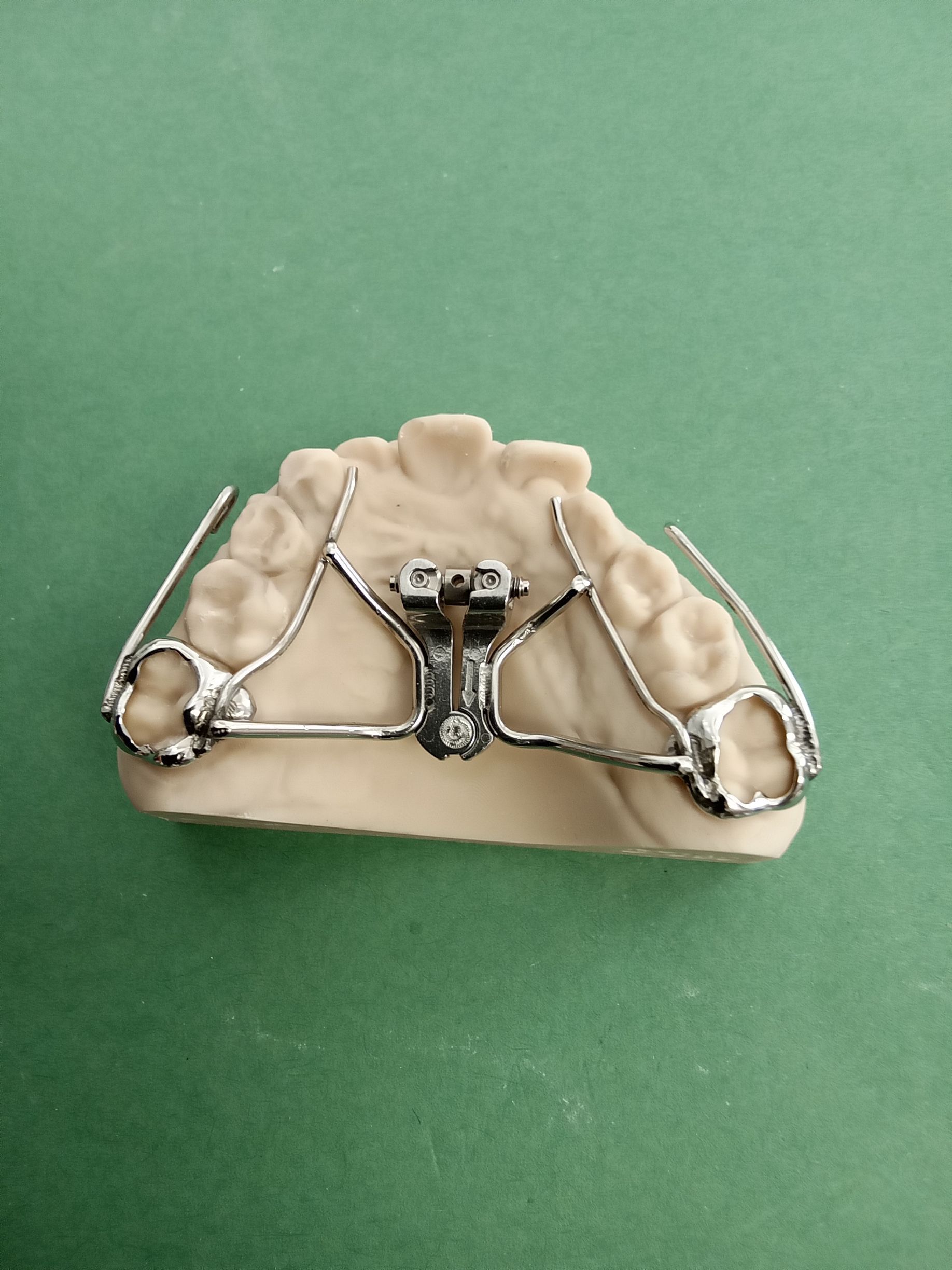 A model of a tooth with braces on it