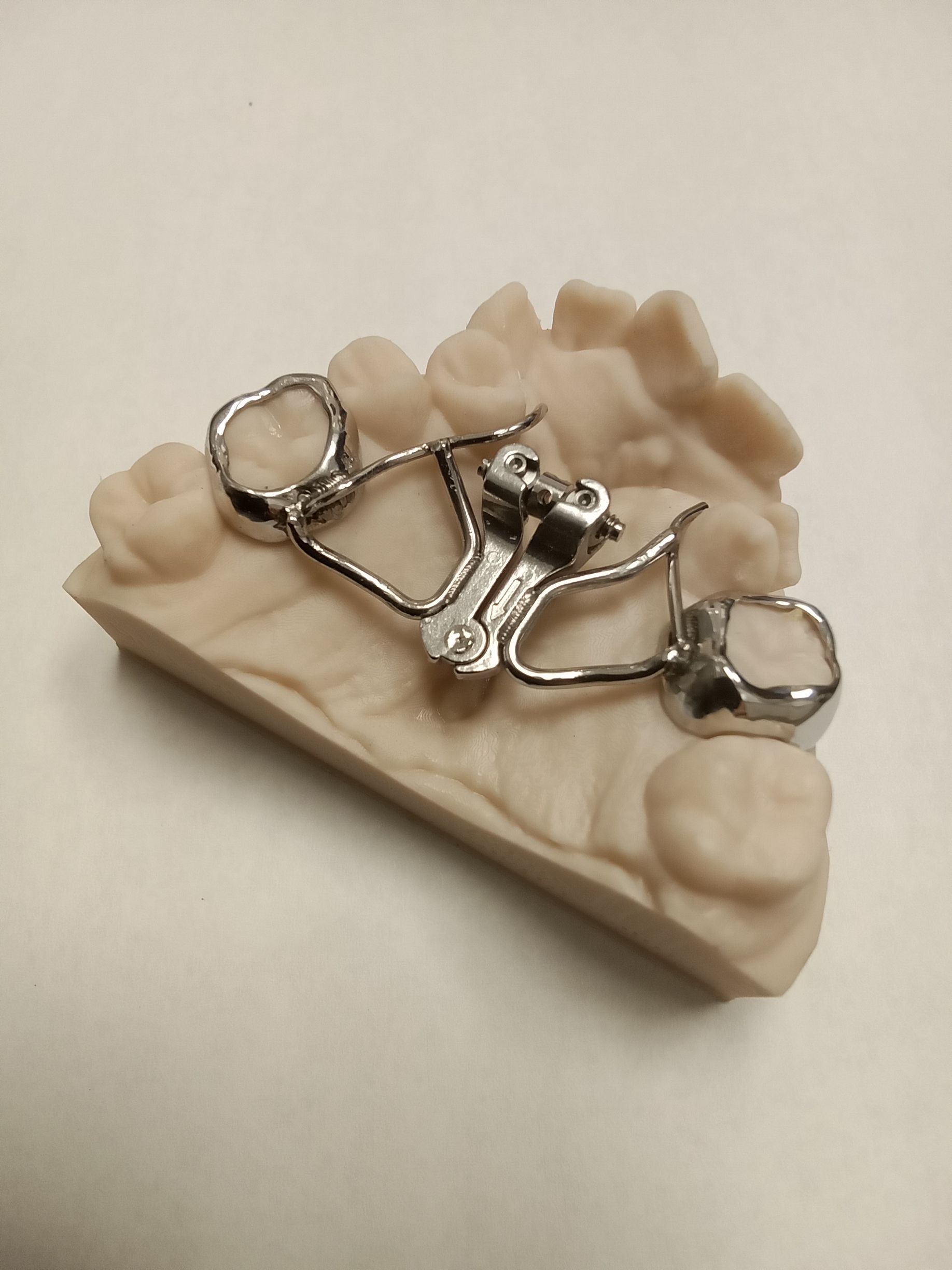 A model of a tooth with a metal brace on it