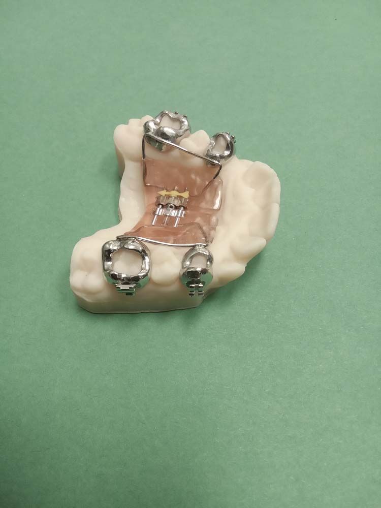 A close up of a dental device on a green surface.