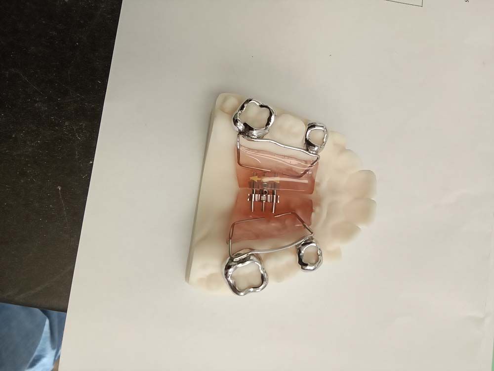 A close up of a dental device on a white surface