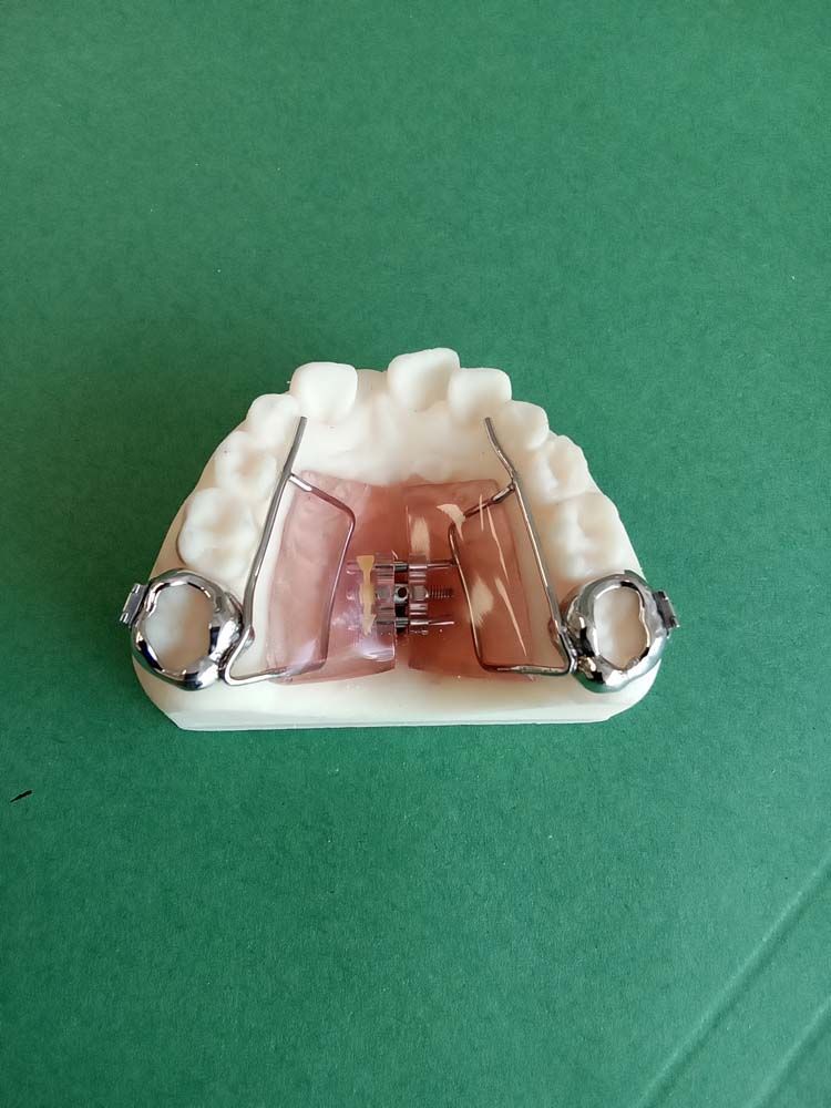 A model of a tooth with braces on it is sitting on a green table.
