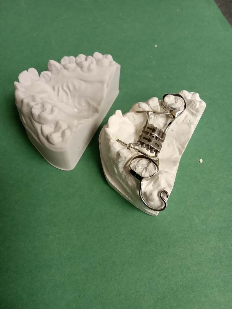 A pair of dental models sitting on top of a green table.