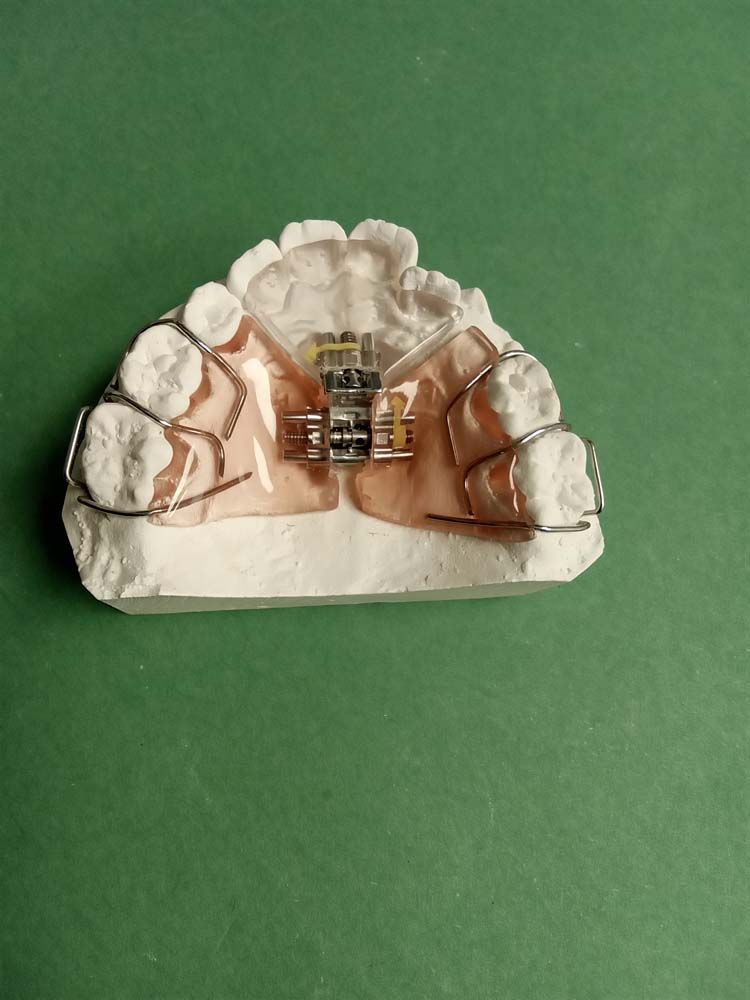 A pair of dental models on a green surface.