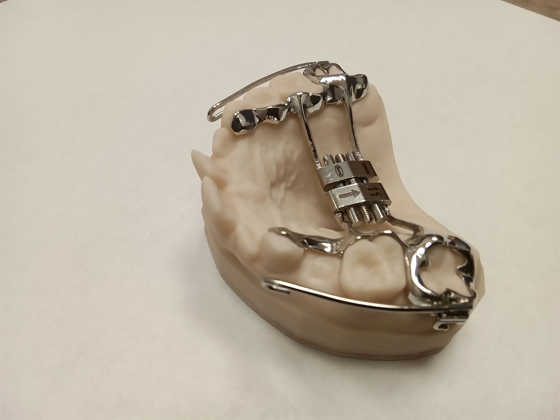 A dental cast displays a Hyrax expander with sintered bands and metal arms featuring FM hooks