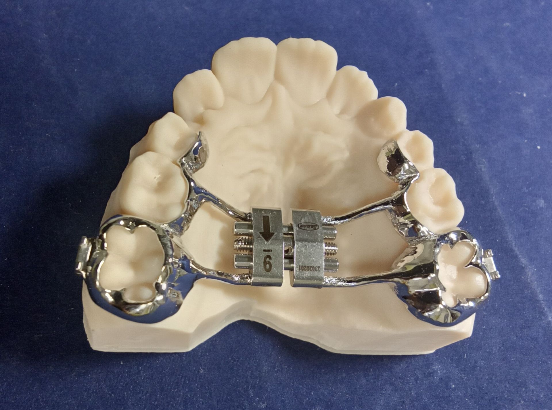 A dental cast shows a Hyrax expander with sintered bands and metal arms extending to the C's