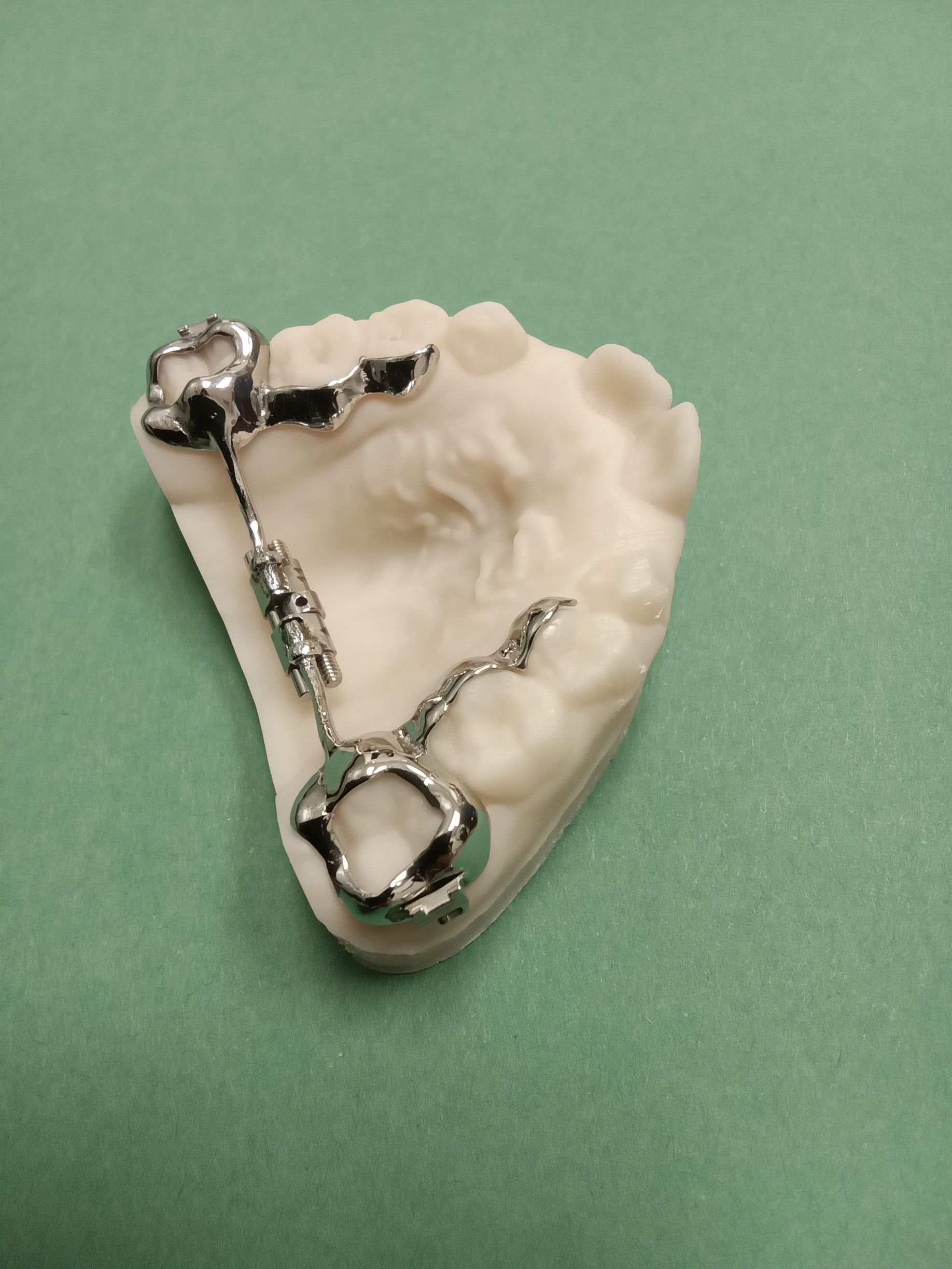 A model of a tooth with a chain attached to it