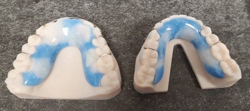 A pair of dental models with blue paint on them are sitting on a table.