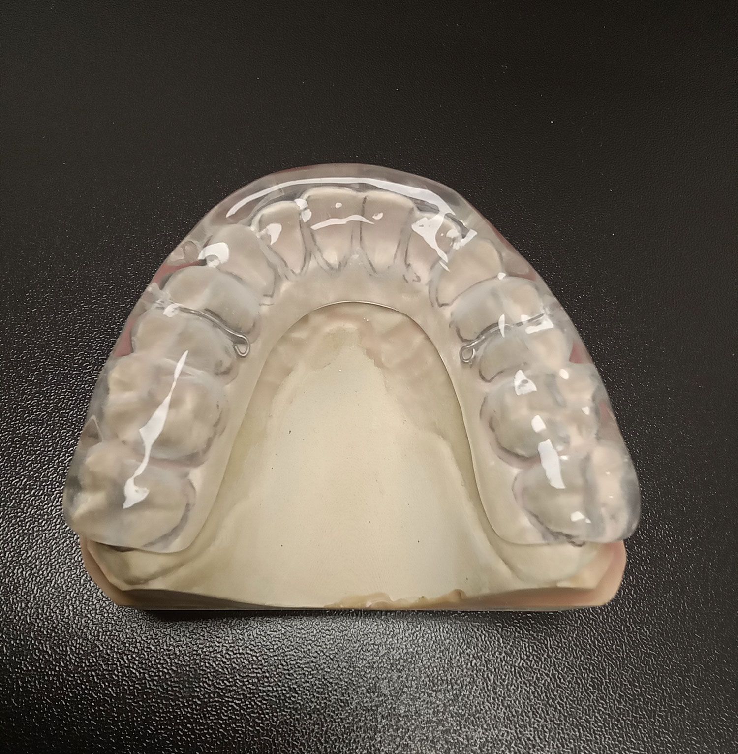 A model of a mouth with a clear brace on it