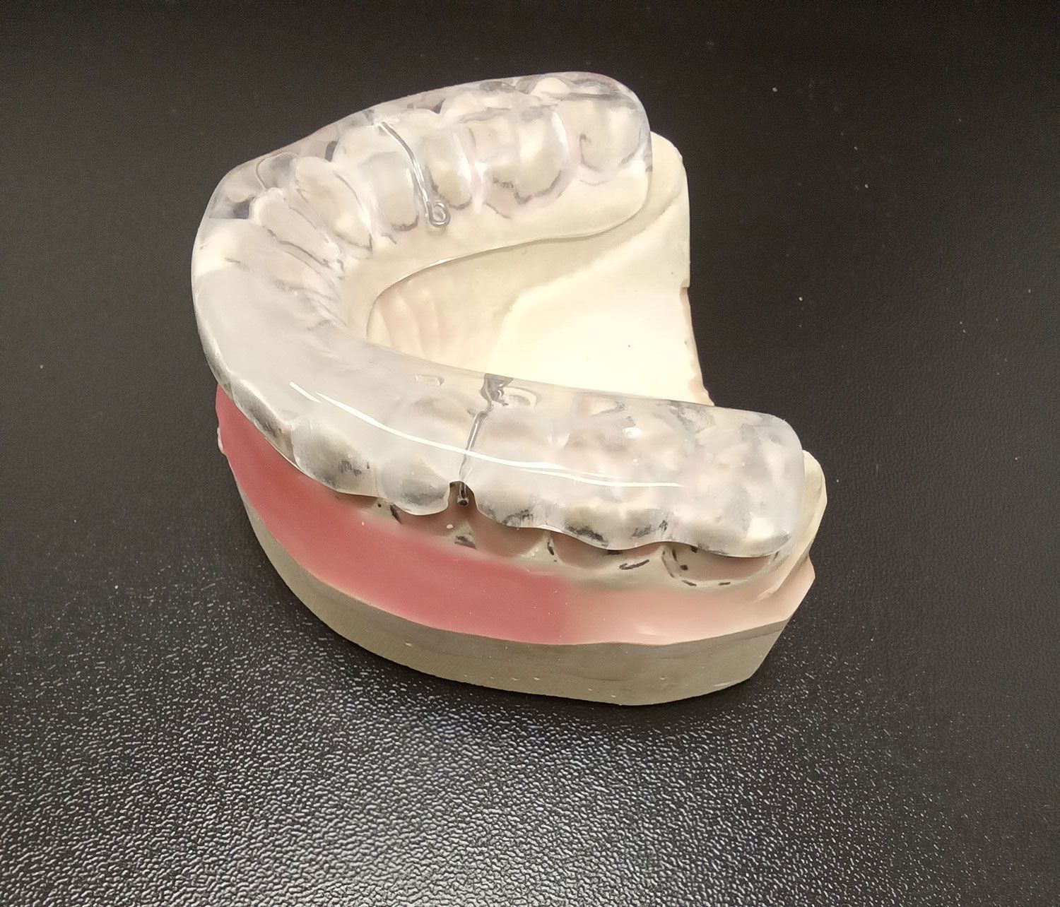 A model of a mouth guard
