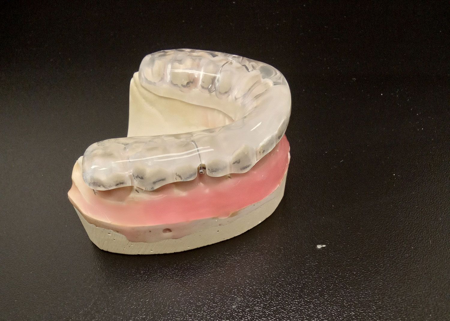 A model of a mouth with a mouth guard