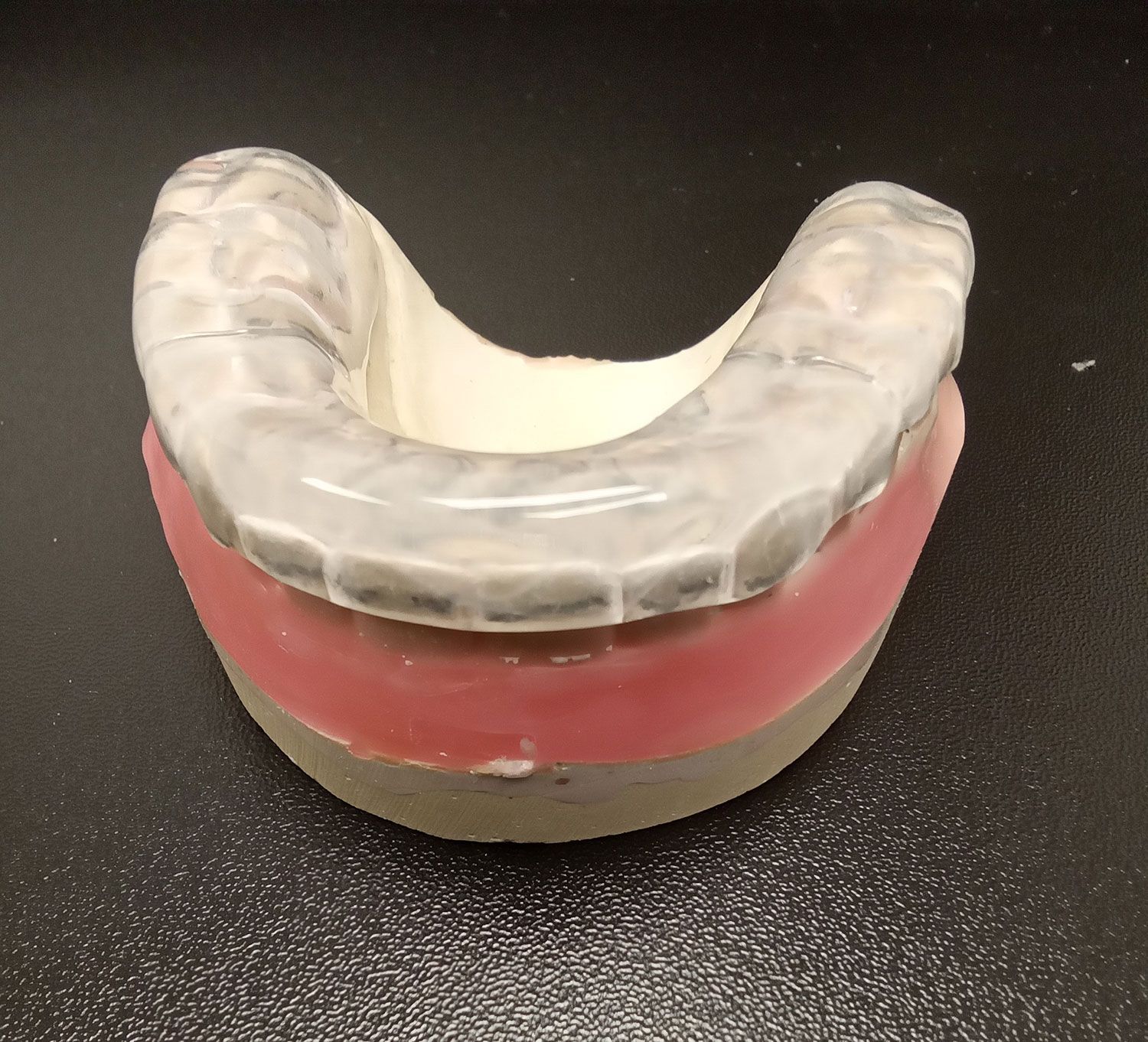 A model of a mouth with a mouth guard on it