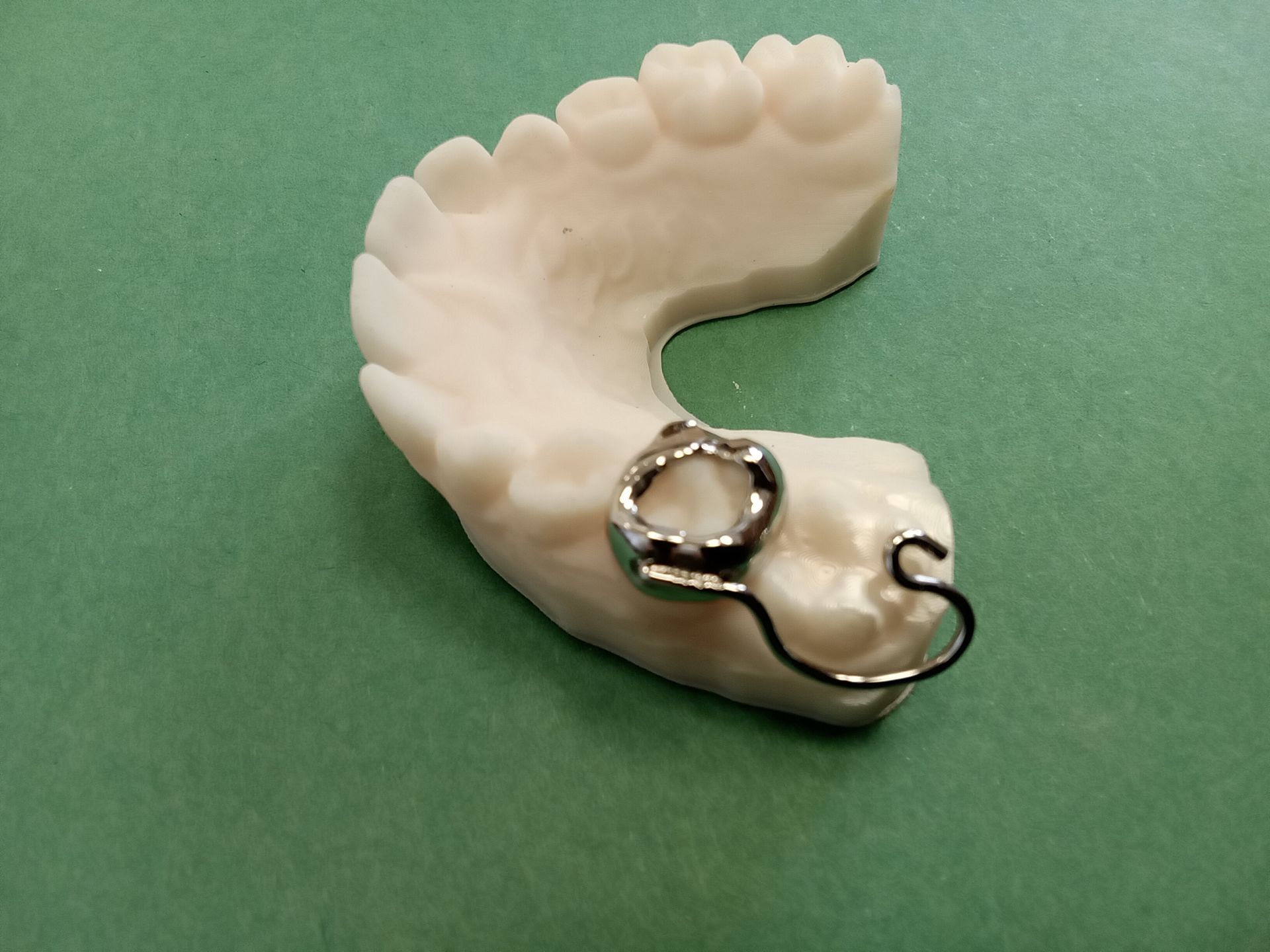 A model of a tooth with a metal ring on it