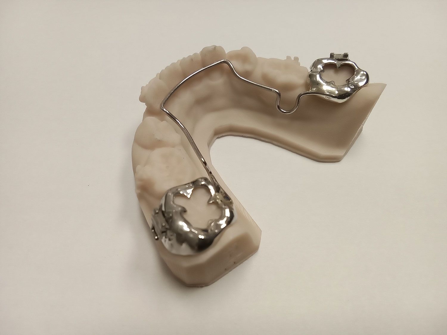 A model of a tooth with a metal brace on it