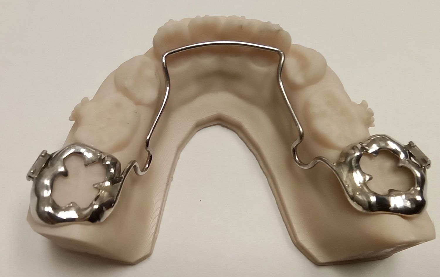 A model of a person's teeth with metal braces on it