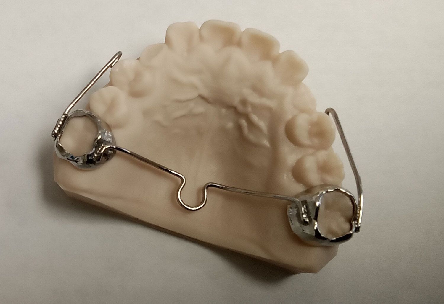 A model of a tooth with a metal brace on it