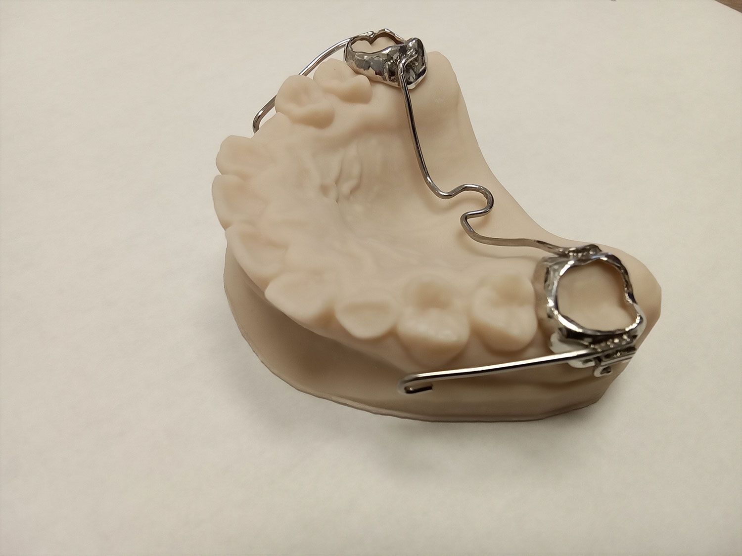 A model of a person's teeth with a metal device attached to it
