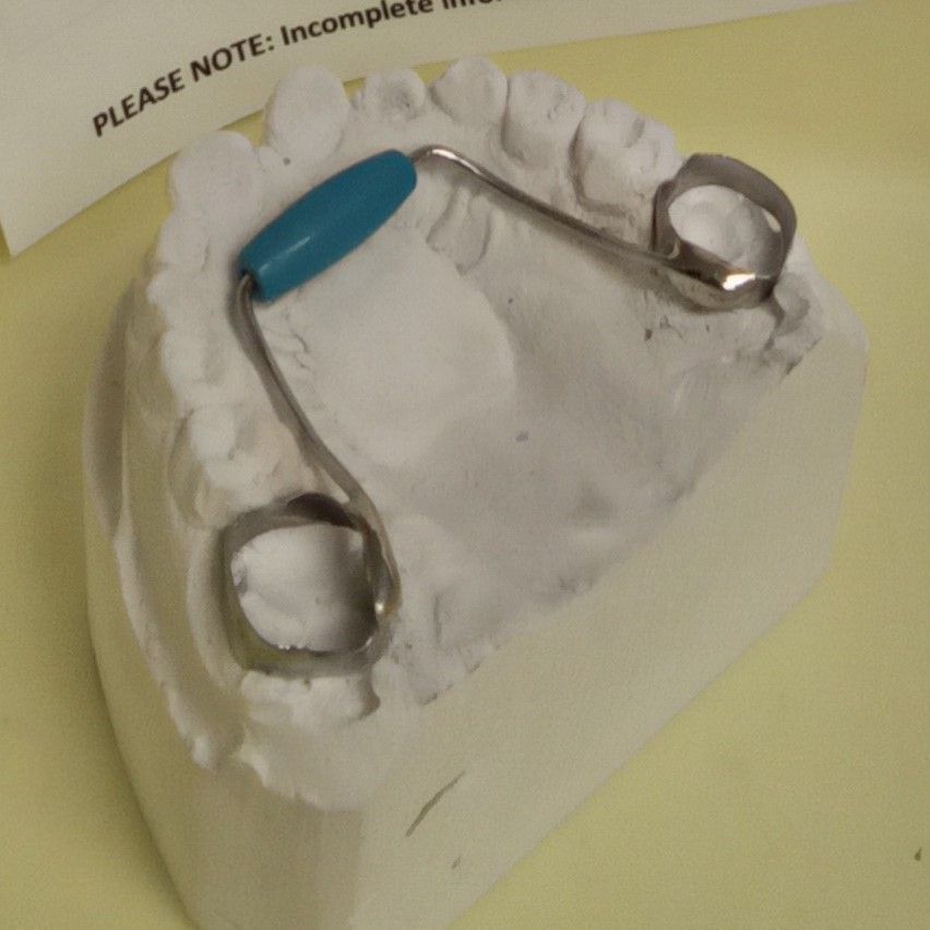 A model of a tooth with a note that says please note incomplete