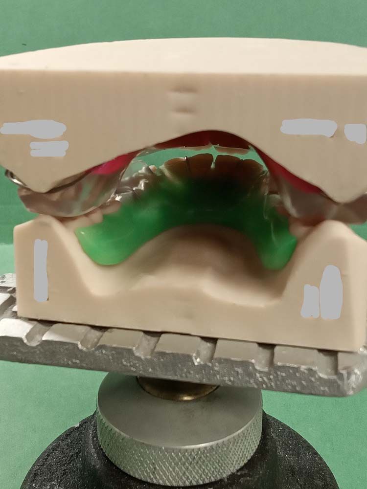 A model of a person's teeth is sitting on a table