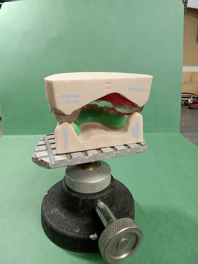 A dental model is sitting on top of a green table.